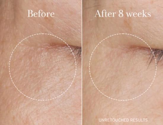 Erkek genel Rose Super - Antioxidant Serum