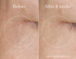 Erkek genel Rose Super - Antioxidant Serum